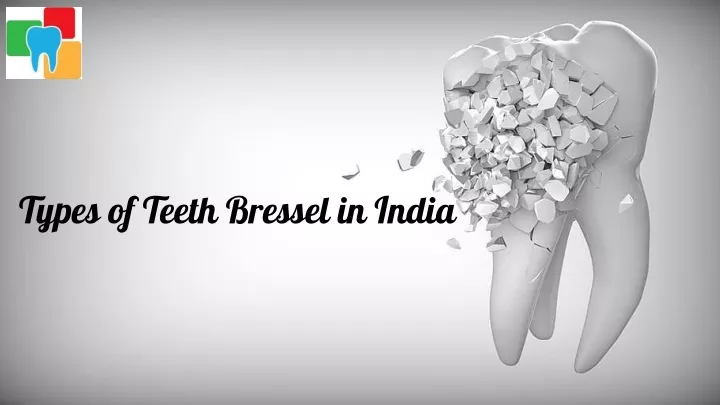 t ype s of teeth bressel in india