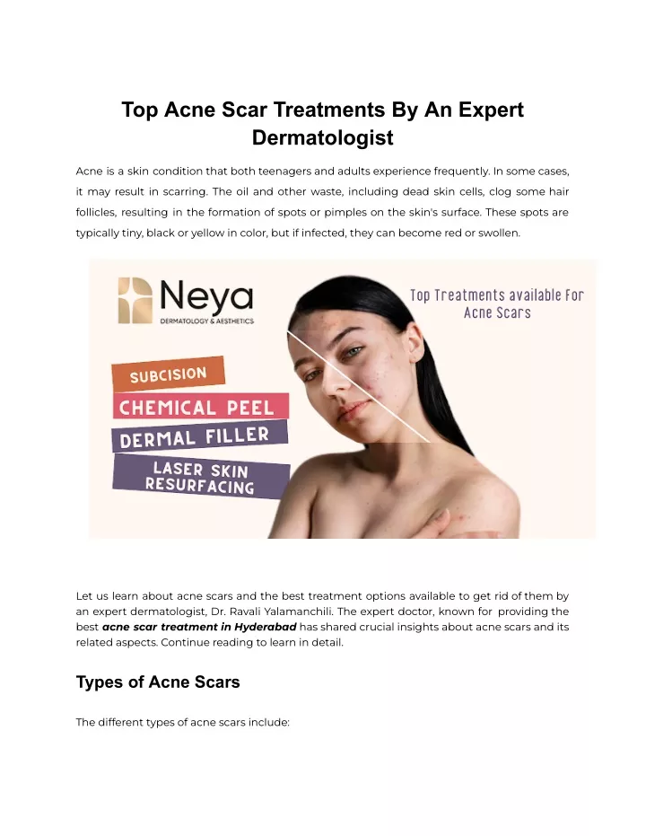 top acne scar treatments by an expert