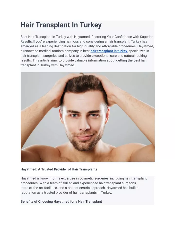 hair transplant in turkey