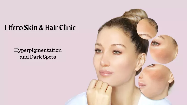 lifero skin hair clinic