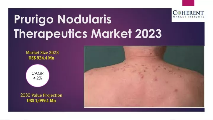 prurigo nodularis therapeutics market 2023