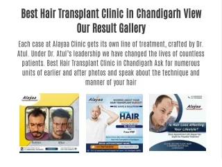 Best Hair Transplant Clinic in Chandigarh View Our Result Gallery