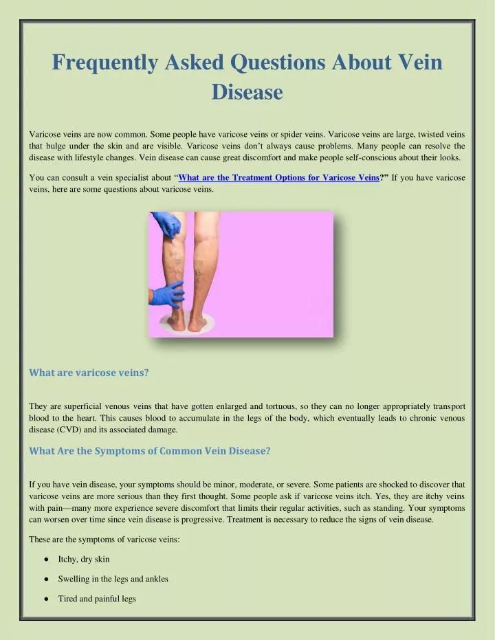 frequently asked questions about vein disease