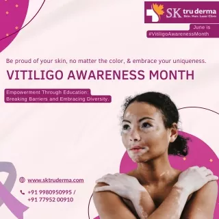 June is Vitiligo Awareness Month | Best Dermatologist in Sarjapur Road | Dr. Kav