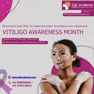 June is Vitiligo Awareness Month | Lady Dermatologist in Sarjapur Road | Dr. Kav