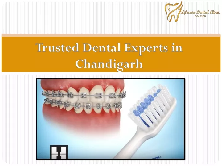 trusted dental experts in chandigarh
