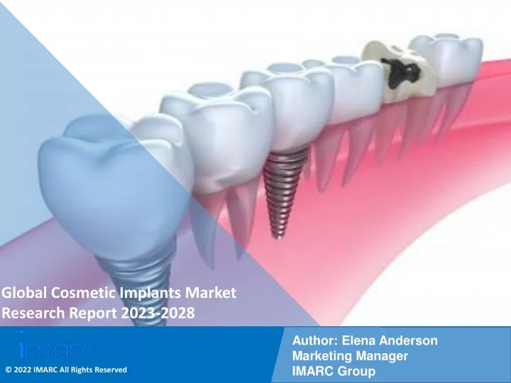 global cosmetic implants market research report