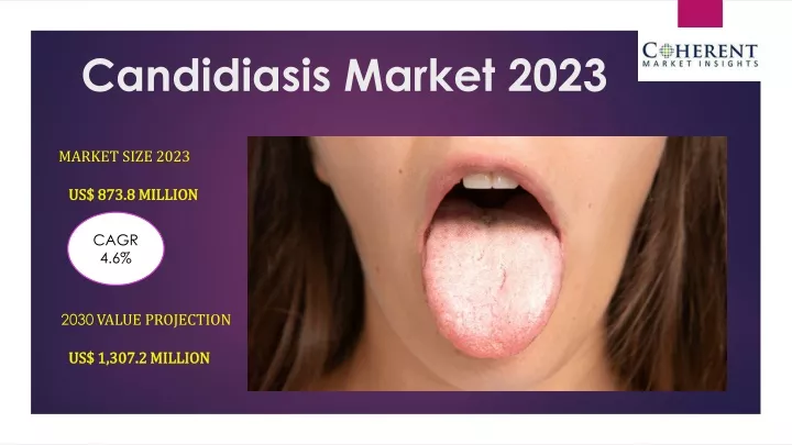 candidiasis market 2023