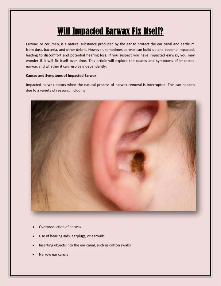 will impacted earwax fix itself will impacted