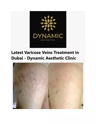 Latest Varicose Veins Treatment in Dubai
