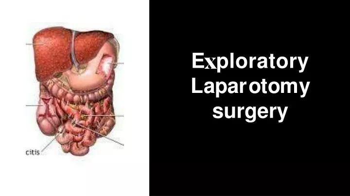 e ploratory l apa r o t o m y surgery