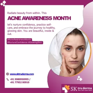 What is Acne | Skin Specialist in Sarjapur Road | Dr. Kavitha GV Mandal