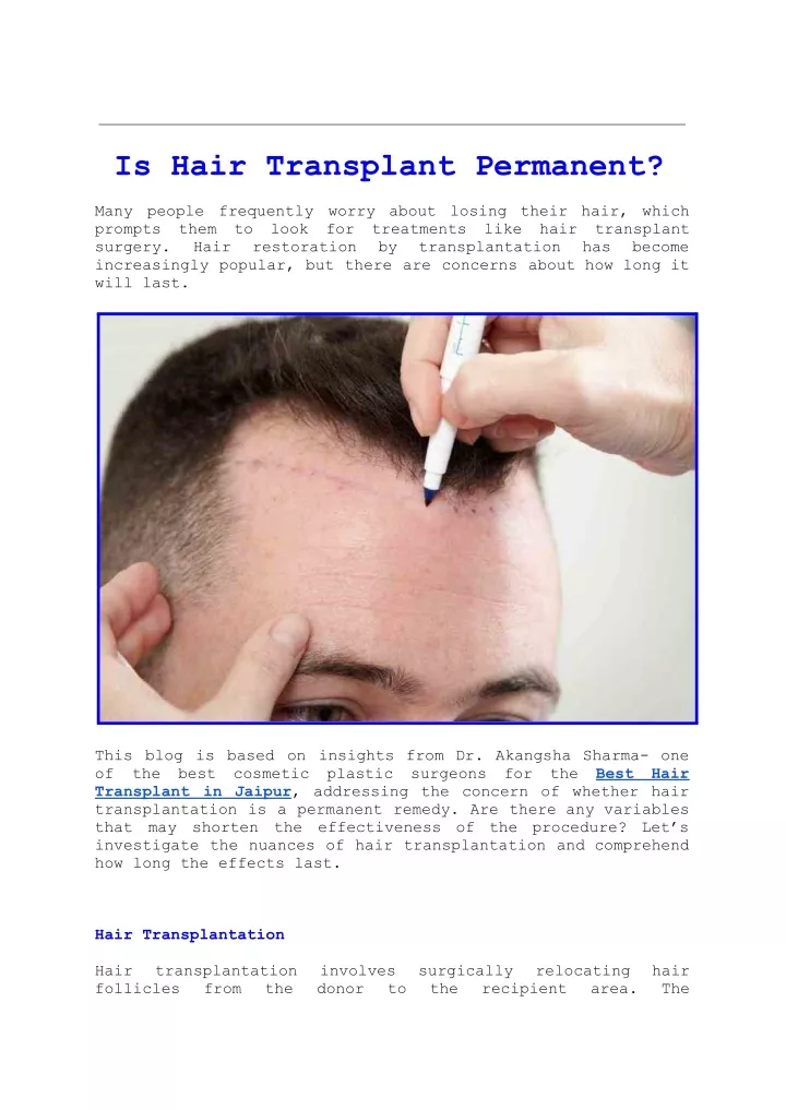 is hair transplant permanent