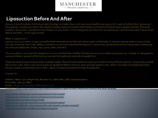 liposuction before and after