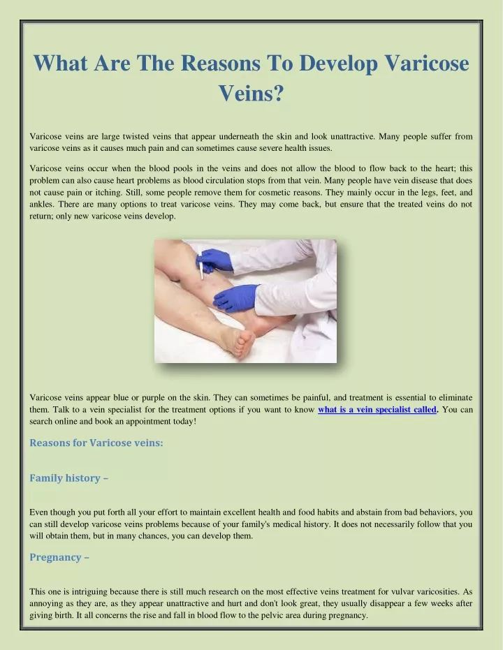 what are the reasons to develop varicose veins