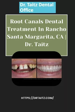 Root Canals Dental Treatment In Rancho Santa Margarita, CA | Dr.Taitz