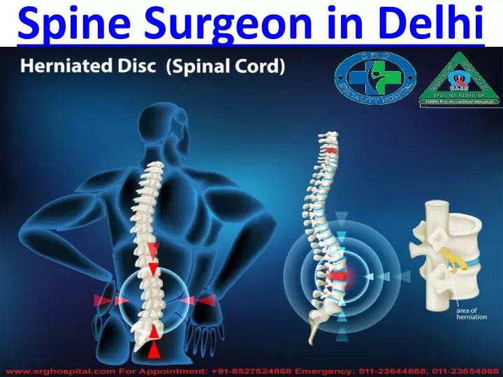 spine surgeon in delhi