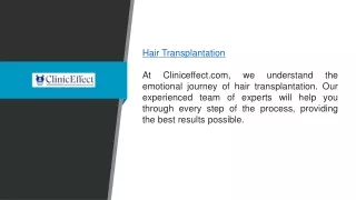 Hair Transplantation  Cliniceffect.com