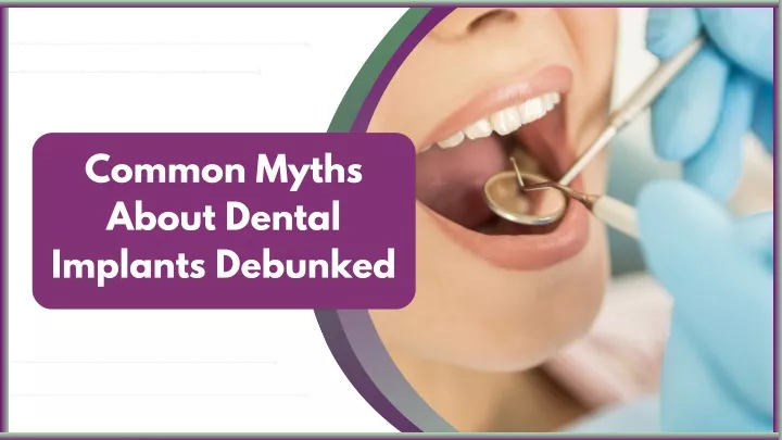 common myths about dental implants debunked