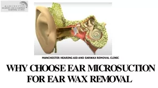 Why Choose Ear Microsuction for Ear Wax Removal