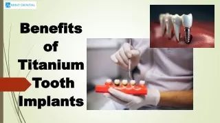 Benefits of Titanium Tooth Implants