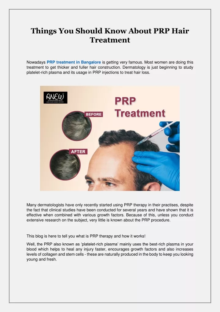 things you should know about prp hair treatment