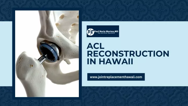 acl reconstruction in hawaii