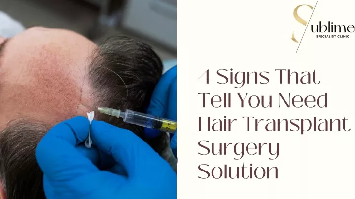 4 signs that tell you need hair transplant