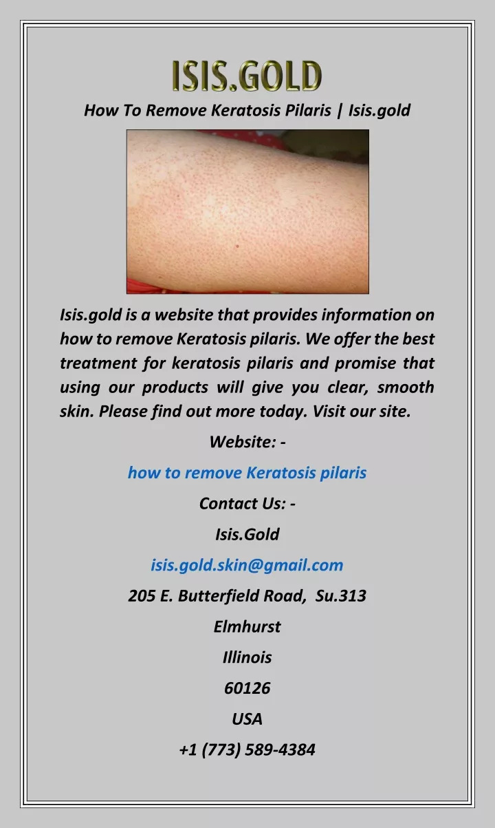 how to remove keratosis pilaris isis gold