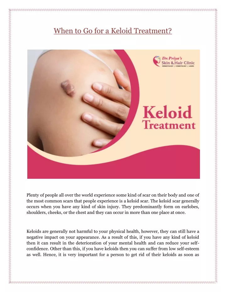 when to go for a keloid treatment