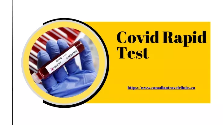 covid rapid test
