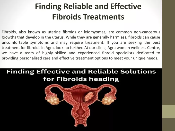 finding reliable and effective fibroids treatments