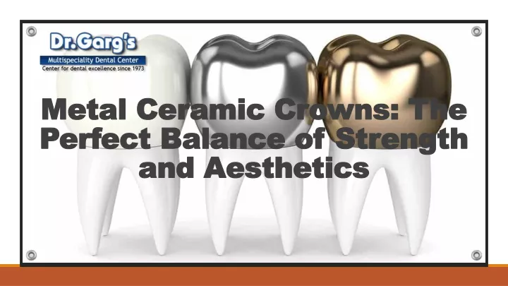 metal ceramic crowns the perfect balance of strength and aesthetics