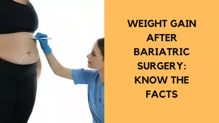 weight gain after bariatric surgery know the facts