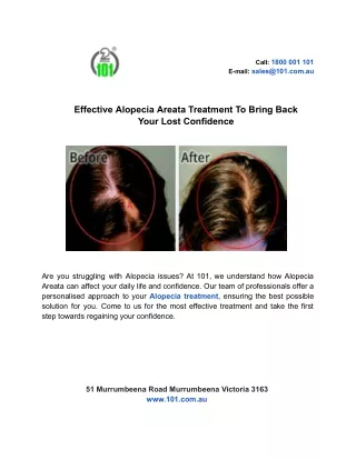 Effective Alopecia Areata Treatment To Bring Back Your Lost Confidence