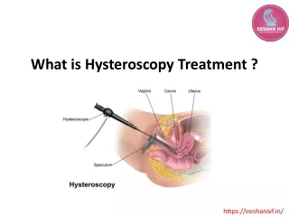 What is Hysteroscopy Treatment