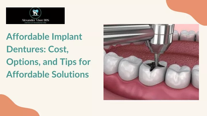 affordable implant dentures cost options and tips