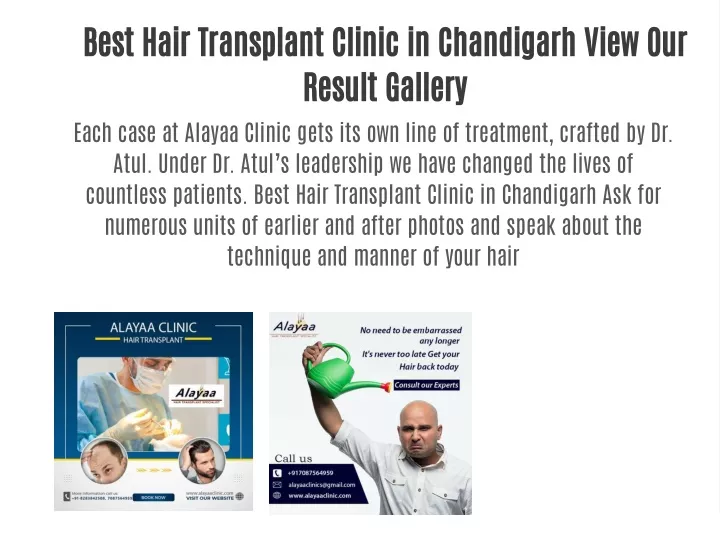 best hair transplant clinic in chandigarh view