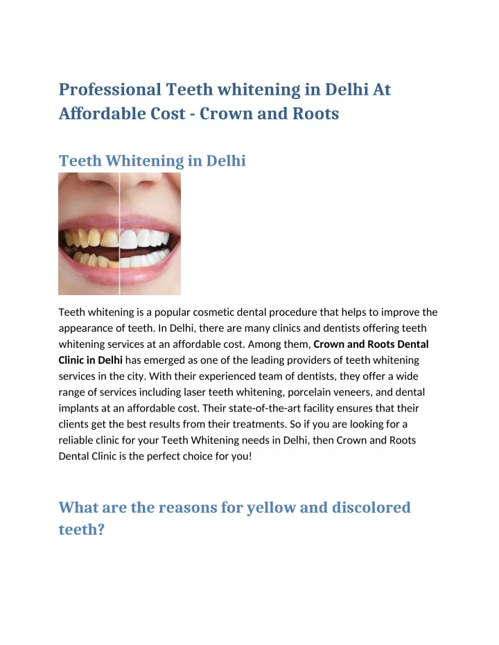 professional teeth whitening in delhi