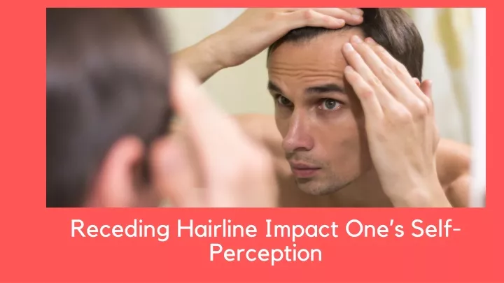 receding hairline impact one s self perception