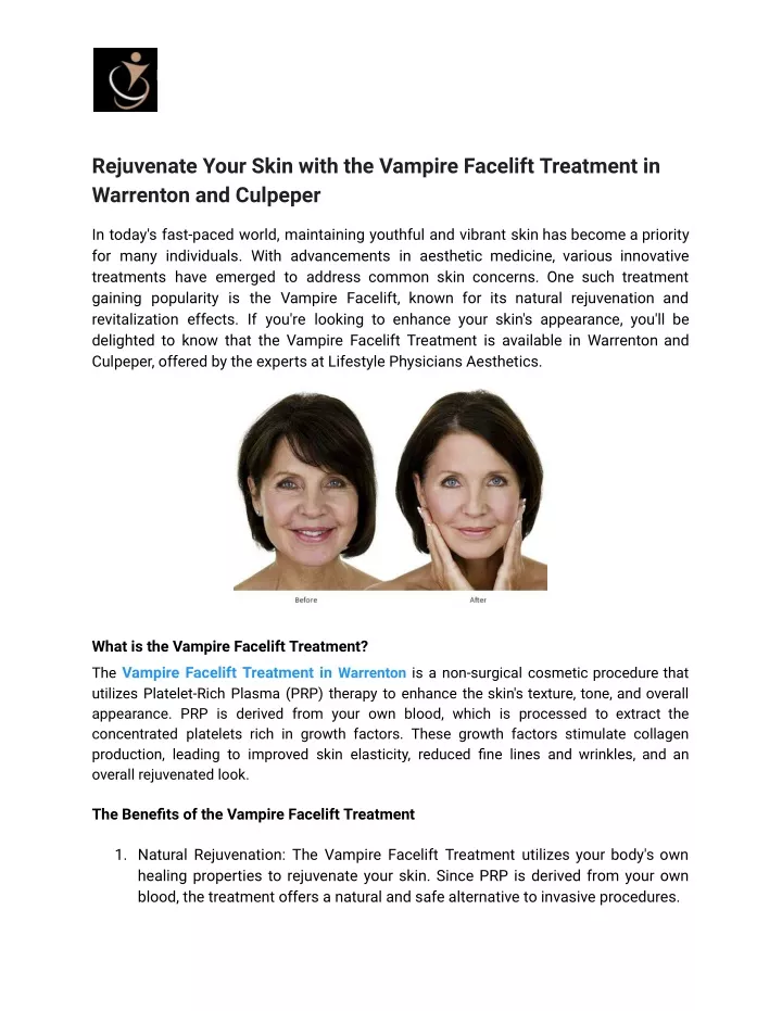 rejuvenate your skin with the vampire facelift