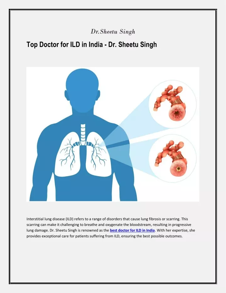 top doctor for ild in india dr sheetu singh