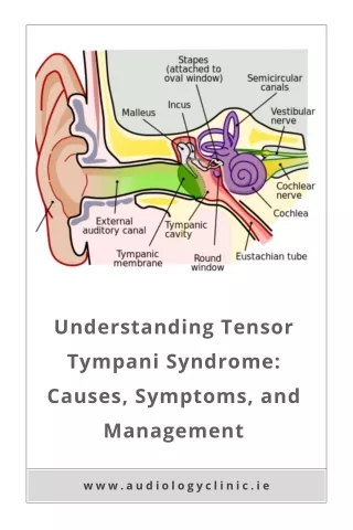 Understanding Tensor Tympani Syndrome Causes, Symptoms, and Management