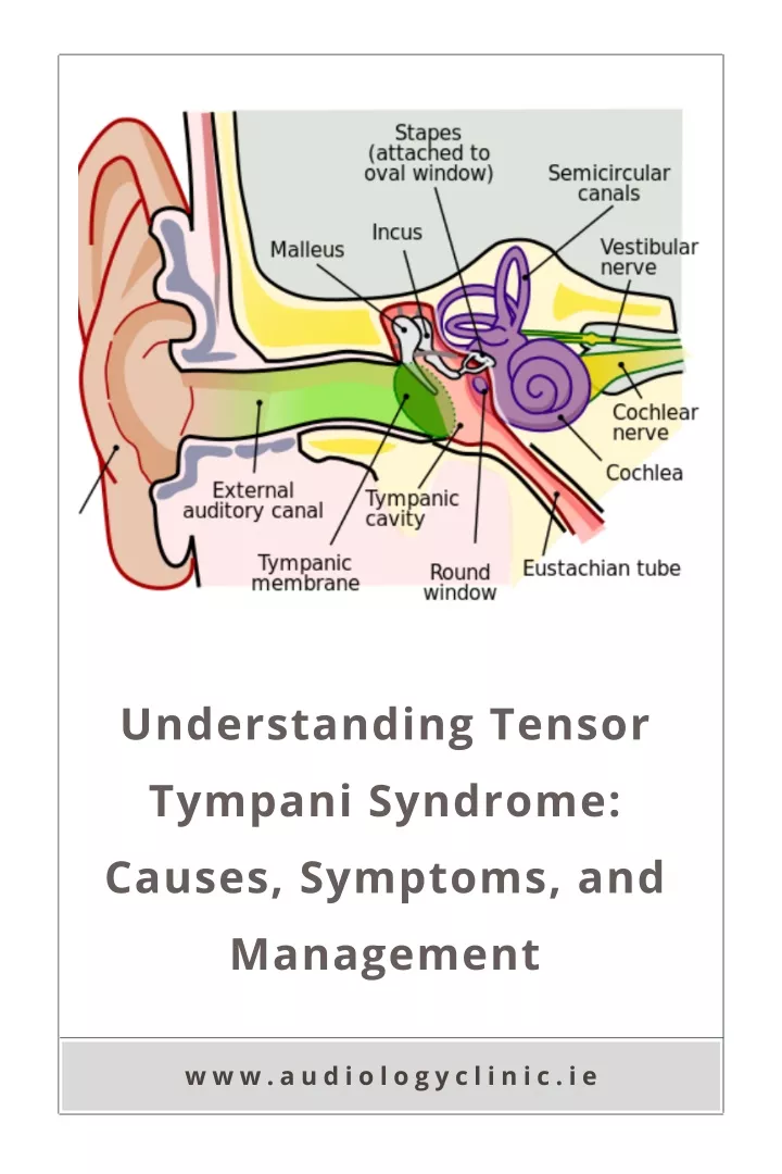 understanding tensor tympani syndrome causes