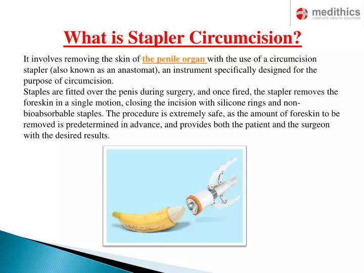 what is stapler circumcision
