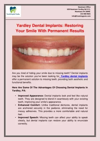 Yardley Dental Implants Restoring Your Smile With Permanent Results