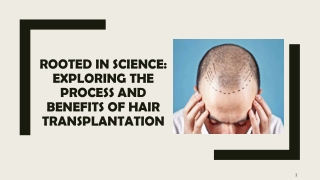 Rooted in Science Exploring the Process and Benefits of Hair Transplantation