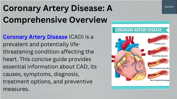 coronary artery disease a comprehensive overview
