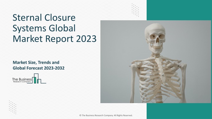 sternal closure systems global market report 2023