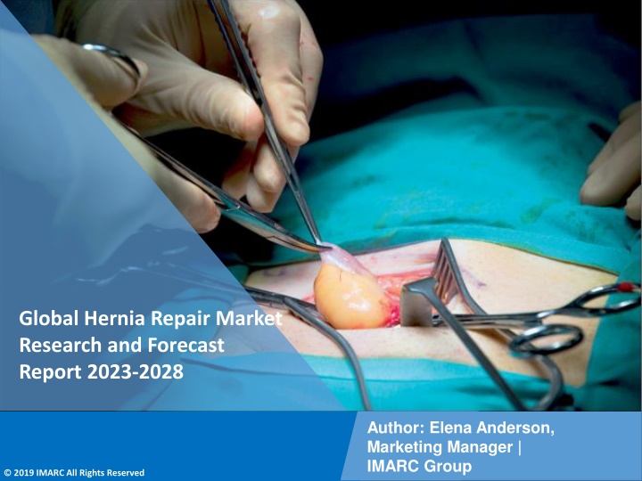global hernia repair market research and forecast